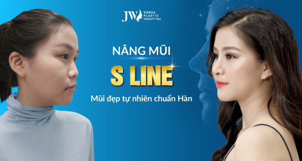 Dáng mũi s line