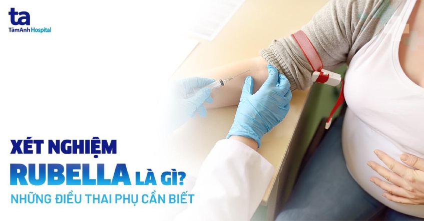 Rubella igg là gì