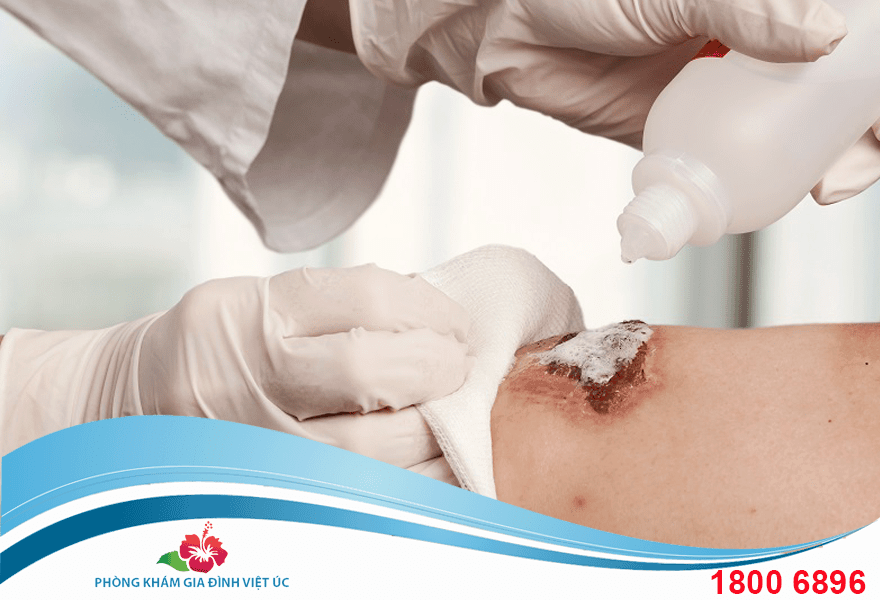 Thuốc rắc vết thương hở