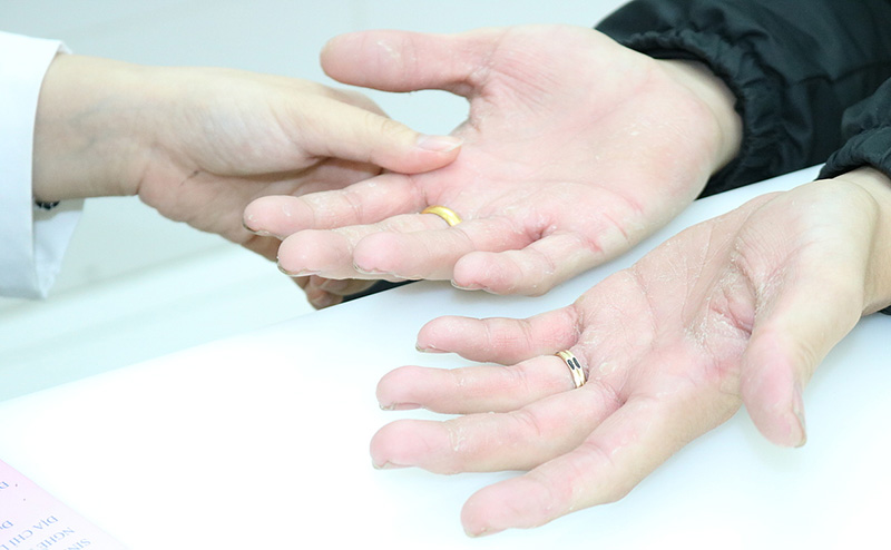 Vaseline dưỡng da tay