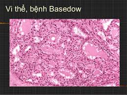 Xét nghiệm anapath là gì